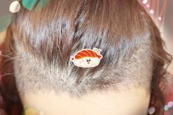 -大麦微针植发全国连锁