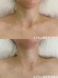 体验前-明潪Selfology升维护理中心