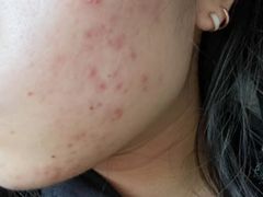 -北京市中关村医院