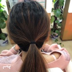 -大麦微针植发丨全国连锁