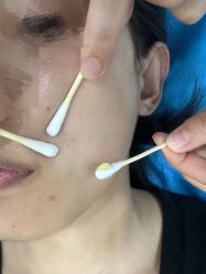体验后-杭州奥拉克医疗美容门诊部