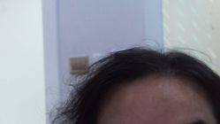 -雍禾植发全国连锁