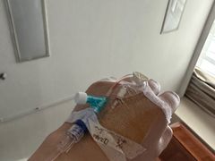 -重庆医科大学附属第一医院(本部)