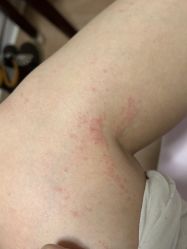 体验后-美莱医学美容医院