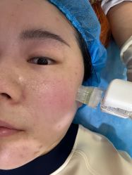 体验前-上海玫瑰医疗美容医院