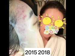 -苗方清颜痘肌研究所