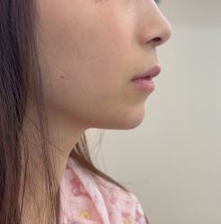 -长沙雅美医疗美容医院