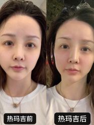 点击看大图 -长沙雅美医疗美容医院