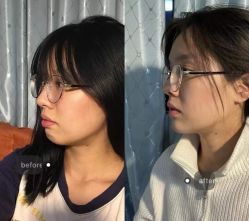-温州伯思立医院