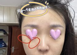 -柠檬一美·Ondapro·轻薄紧致抗衰中心