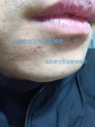 -美人痣全国连锁