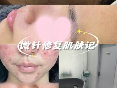 -上置·美兰优湖