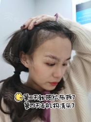 -雍禾植发全国连锁