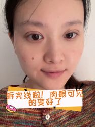 -素美医疗美容·西南眼鼻整形·修复基地
