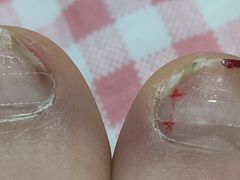 -新甲连锁灰指甲·甲沟炎·鸡眼(黑龙江路店)