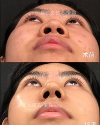 -北京米扬丽格医疗美容·联合丽格鼻整形中心