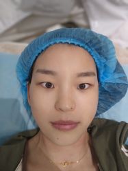 体验后-武汉颜范薇美医疗美容门诊部