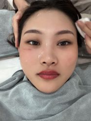 -skin79皮肤管理中心