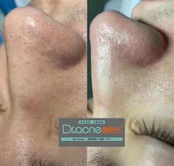 -痘院长·祛痘·科技美肤