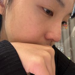 -柠檬一美·Ondapro·轻薄紧致抗衰中心