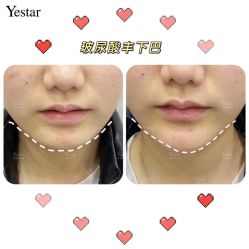 -Yestar艺星医疗美容医院