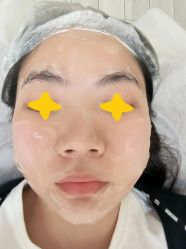 体验后-上海首尔丽格医疗美容医院