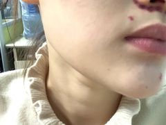 -上海市皮肤病医院(武夷路院区)