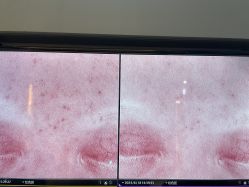 -苑苑vbeauty科技美容SPA