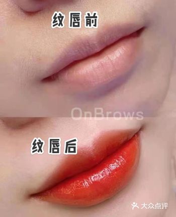 纹唇后，喝水不沾杯，吃饭不擦嘴
