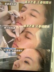 -Yestar艺星医疗美容医院