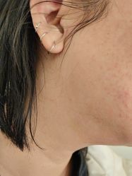 -海涛医疗美容·面部抗衰·注射美鼻