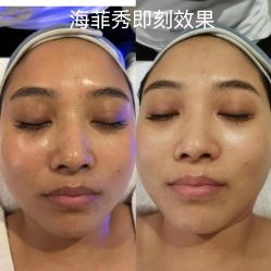 -安吉拉青春化管理中心