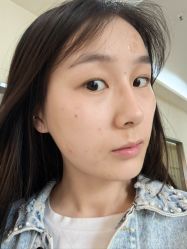 体验后-重庆宝丽医疗美容