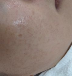 -痘博士北京·全国连锁祛痘机构