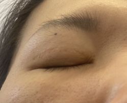 -深圳阳光医疗美容医院·旗舰店