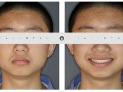 -齐玉齿科JADENTAL
