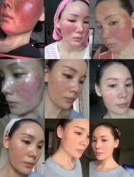 -LUNA皮相美·骨相美高级美感