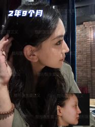 -北京米扬丽格医疗美容·联合丽格鼻整形中心