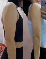 -郡艺医疗美容·微整·眼鼻吸脂