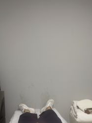 -悟空祛痘·诺奖技术专业店