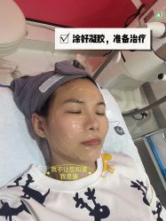 -广州健丽·去眼袋医疗美容机构
