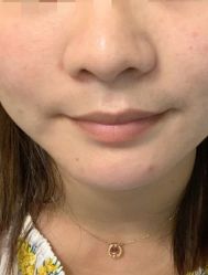 点击看大图 -安徽合肥韩美整形外科医院