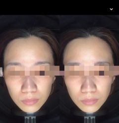 -Deeplus+韩国皮肤管理한국피부관리·C:Lab肌肤实验室