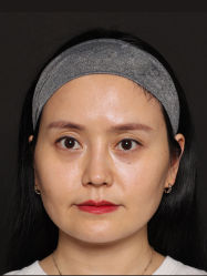 -四川米兰柏羽医学美容医院