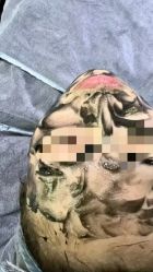 点击看大图 -SKIN79皮肤管理中心