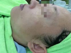 -苗医生草本科技祛痘