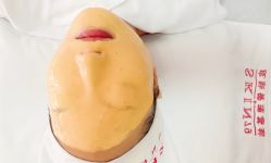 -skin79皮肤管理基站