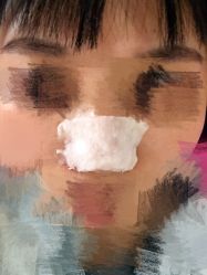 -成都苗方清颜专业祛痘