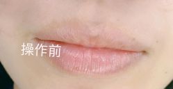 -MISS STAR·半永久纹眉·发际线·美瞳线