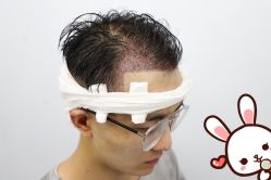 点击看大图 -大麦微针植发丨全国连锁